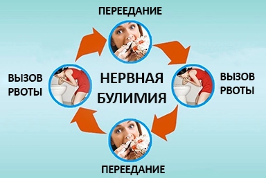 Лечение булимии в Голышманово